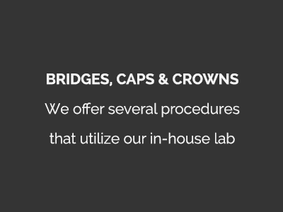 Bridges, Caps and Crowns