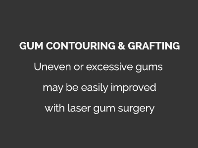 Gum Contouring