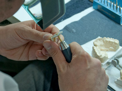 Our In-House Dental Lab - Dr. Sun practices dentistry as an artist, creating all of her own porcelain and other dental restorations in her own in-house dental lab, working with a team of highly trained dental technologists and advanced state of the art equipment (Click or Tap anywhere to close window)