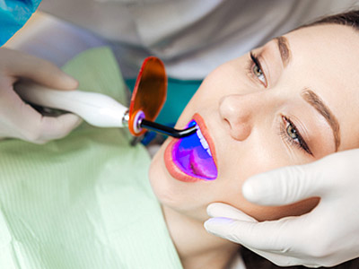 Laser Bleaching -- Get a fresh bright smile in one visit.