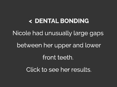 Dental Bonding